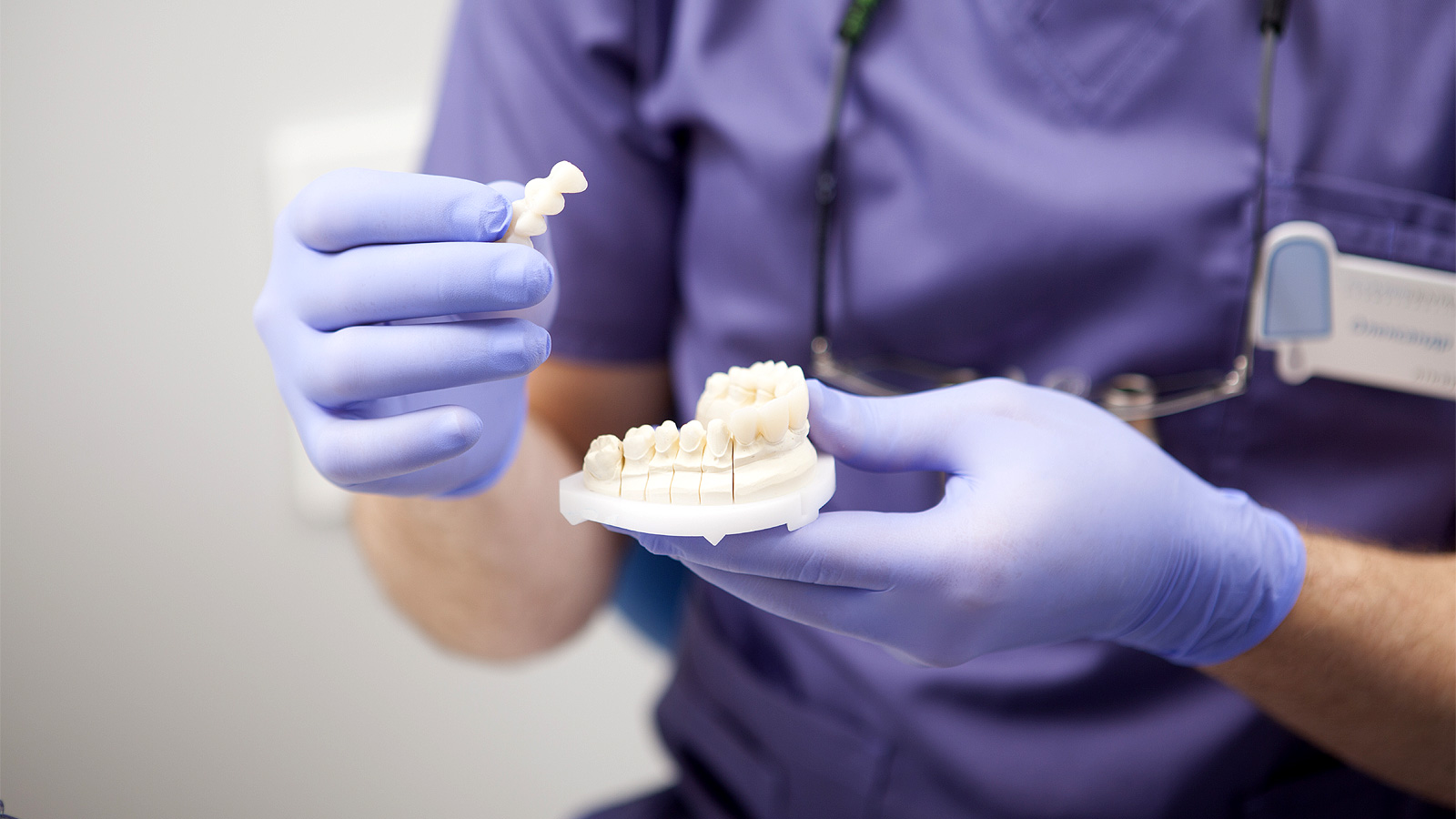 punte dentară și model de maxilar în mâinile medicului
