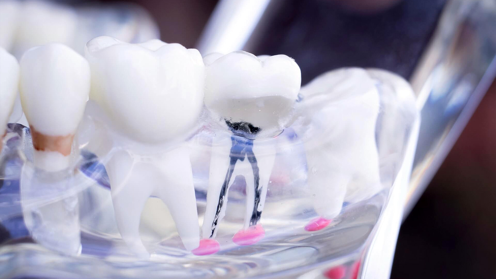 Fragment al unui model de mandibulă și dinte cu canale radiculare