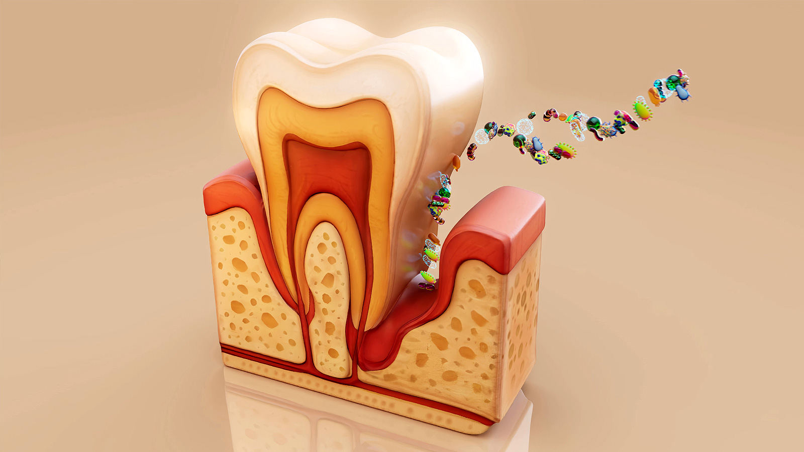 3-D изображение зуба с десной, воспаленной из-за парадонтита